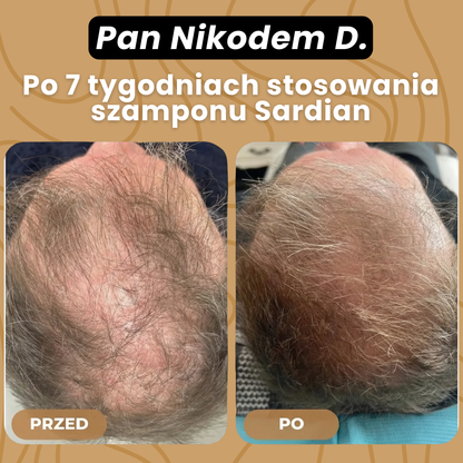 SARDIAN - Szampon Aktywujący Korzenie