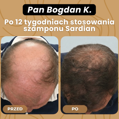 SARDIAN - Szampon Aktywujący Korzenie
