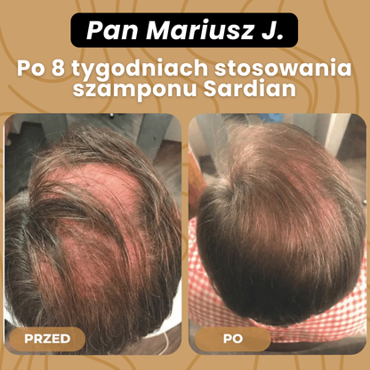 SARDIAN - Szampon Aktywujący Korzenie